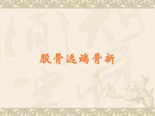 股骨远端骨折