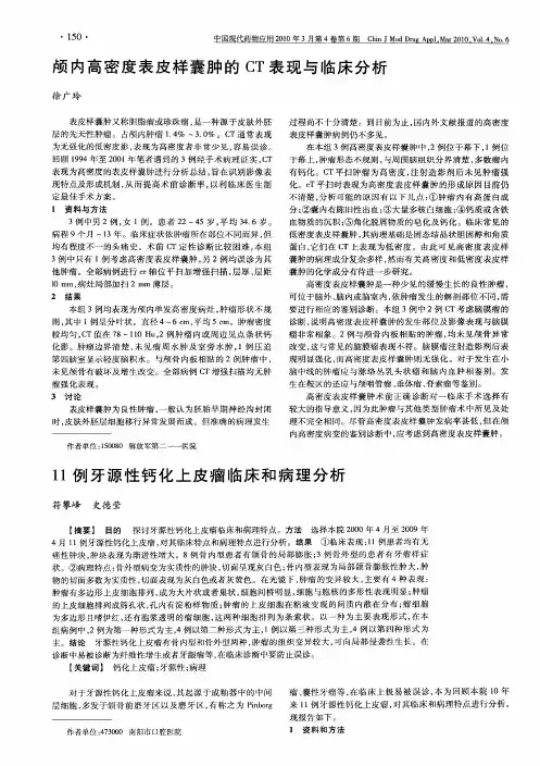 颅内高密度表皮样囊肿的CT表现与临床分析