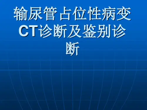 输尿管占位性病变CT诊断及鉴别