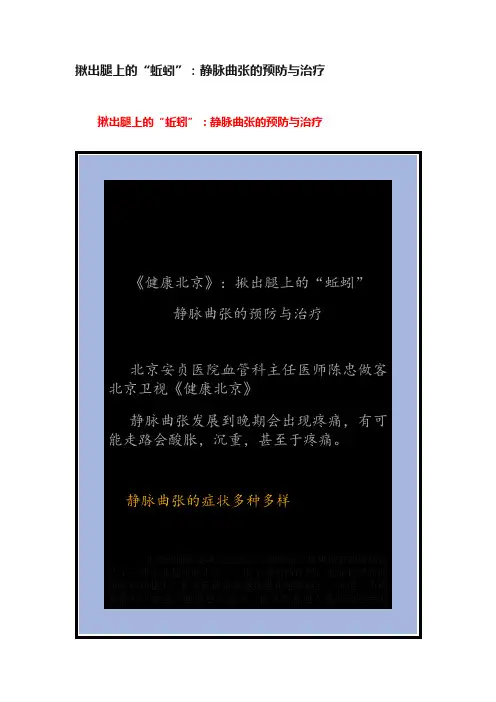 揪出腿上的“蚯蚓”：静脉曲张的预防与治疗