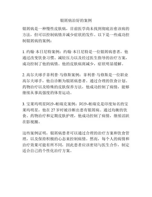 银屑病治好的案例