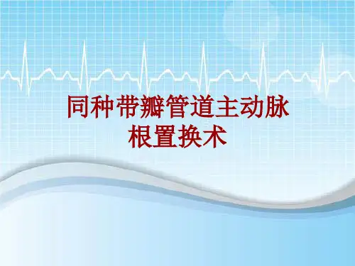 手术讲解模板：同种带瓣管道主动脉根置换术
