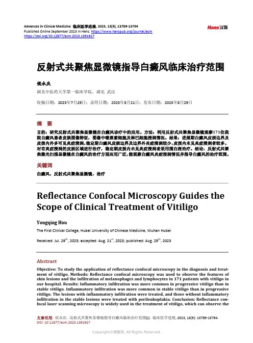 反射式共聚焦显微镜指导白癜风临床治疗范围