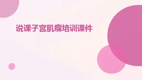 说课子宫肌瘤培训课件