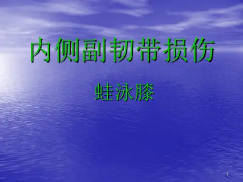 内侧副韧带损伤PPT课件