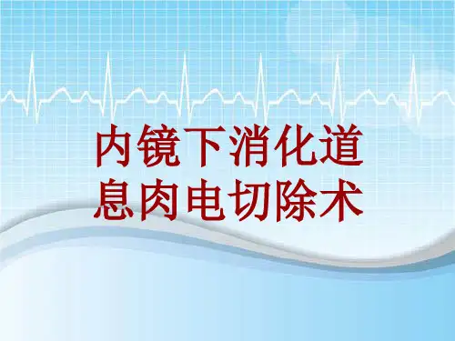 手术讲解模板：内镜下消化道息肉电切除术