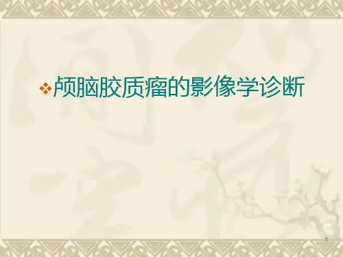 脑胶质瘤的影像学表现 PPT课件