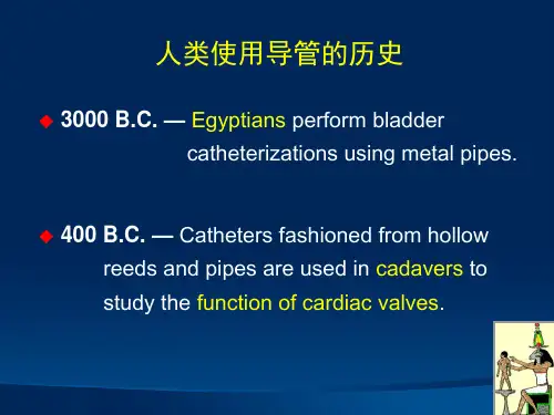 指引导管的选择和操作技术