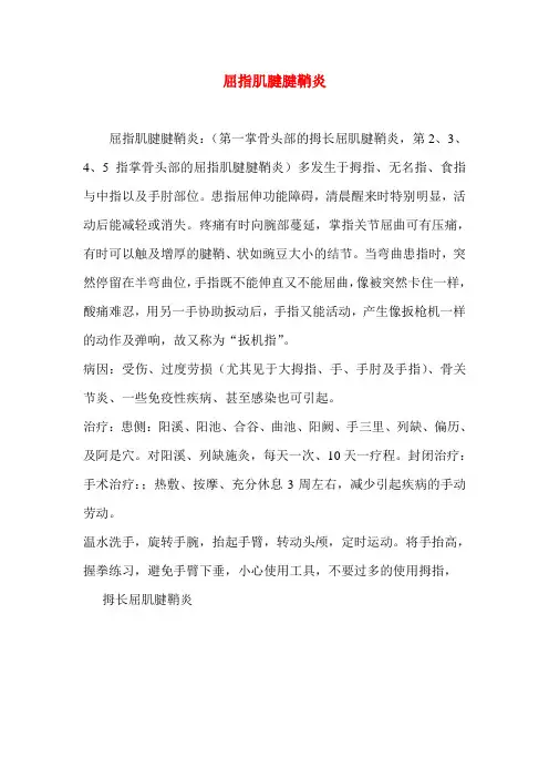 屈指肌腱腱鞘炎