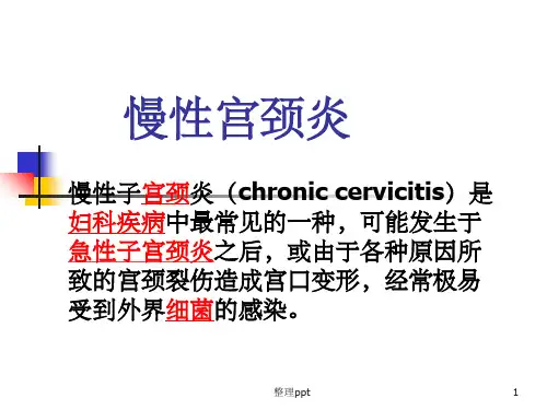 慢性宫颈炎