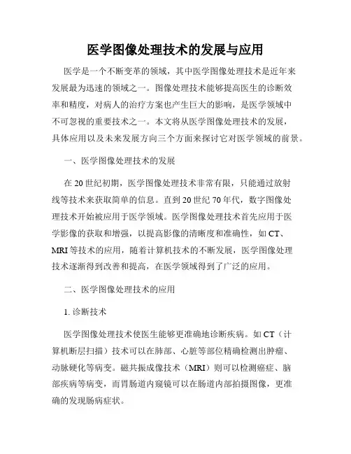 医学图像处理技术的发展与应用