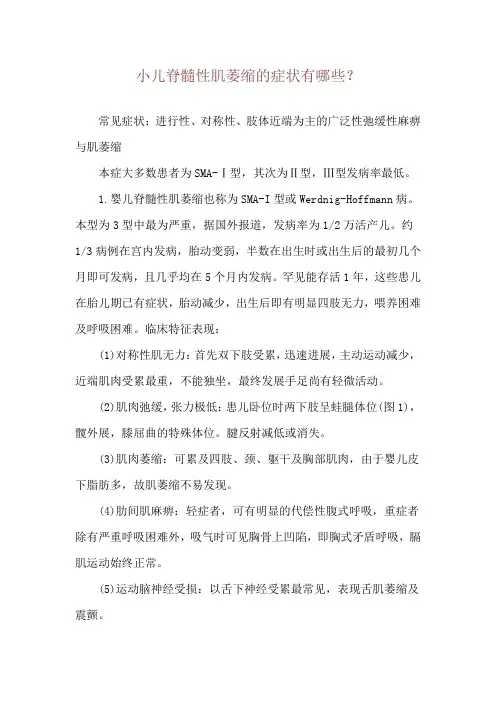 小儿脊髓性肌萎缩的症状有哪些？