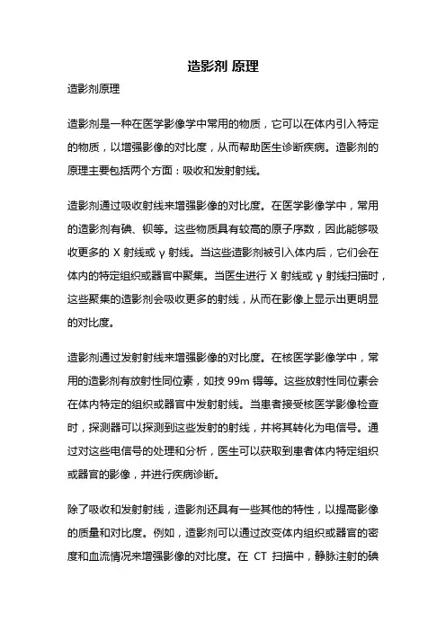 造影剂 原理