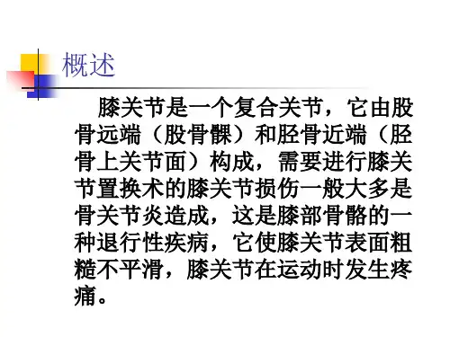 人工全膝关节置换术护理查房PPT课件
