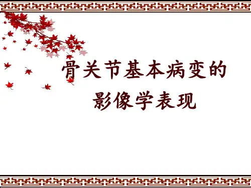 骨关节基本病变的影像学表现
