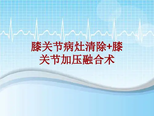 手术讲解模板：膝关节病灶清除+膝关节加压融合术
