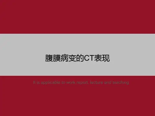 腹膜病变的CT表现