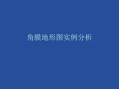 2016年最新版角膜地形图分析汇编