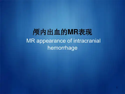 颅内出血的MR表现PPT课件