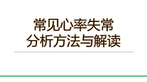 常见心律失常分析方法与解读