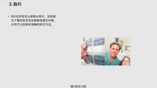 整个牙齿矫正详细过程课件PPT教学
