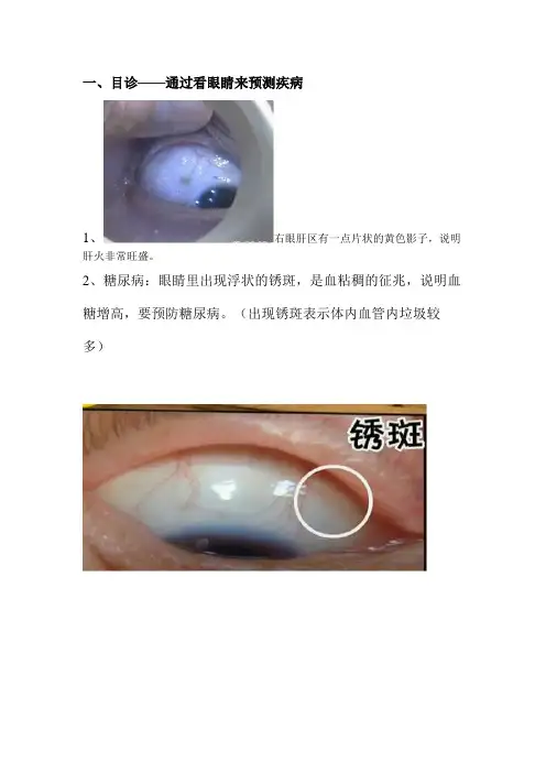 眼诊