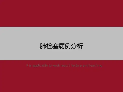 肺栓塞病例分析