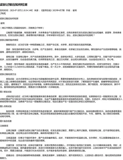 皮肤过敏应如何检测
