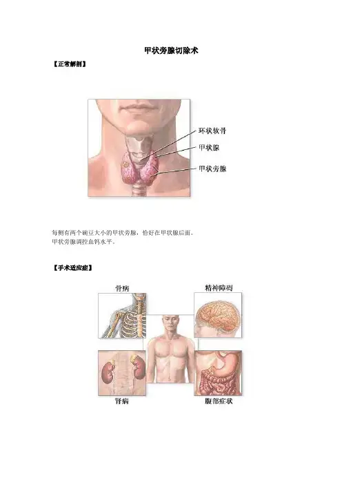 甲状旁腺切除术