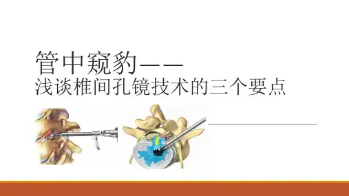 椎间孔镜技术的三个要点!