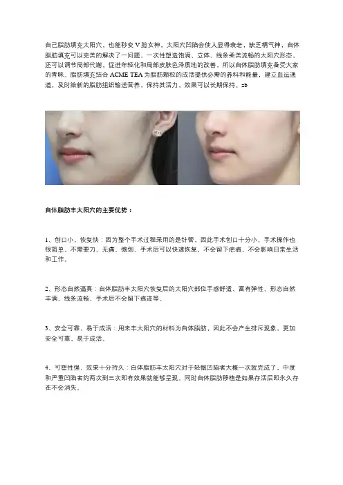 自己脂肪填充太阳穴,也能秒变V脸女神