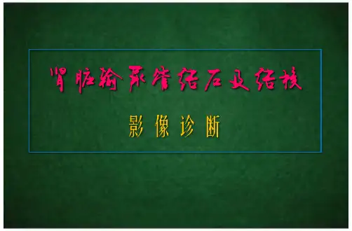 肾脏输尿管结石、结核、肾囊肿影像诊断