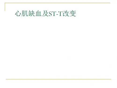 第四次课__心肌缺血、梗塞 共54页PPT资料
