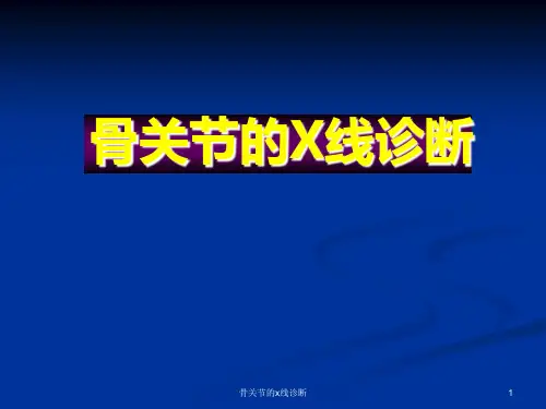 骨关节的x线诊断课件