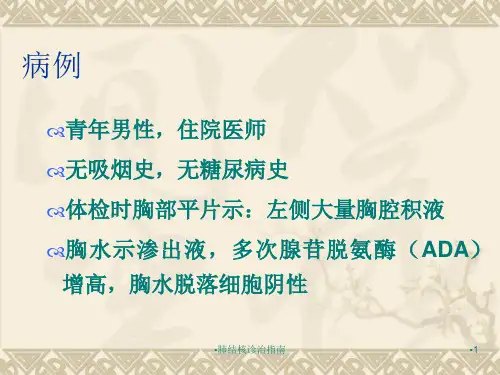 肺结核诊治指南课件