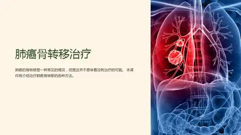 《肺癌骨转移治疗》课件