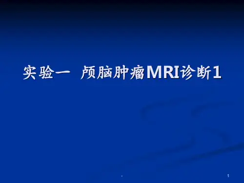 颅脑肿瘤MRI1PPT课件