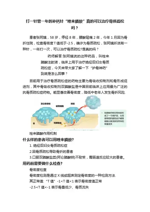 打一针管一年的补钙针“唑来膦酸”真的可以治疗骨质疏松吗？