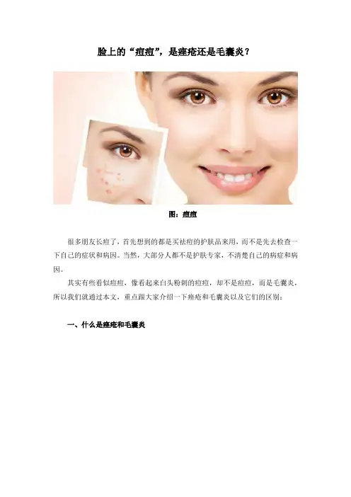 脸上的“痘痘”,是痤疮还是毛囊炎？
