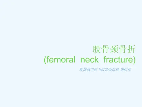 股骨颈骨折课件 ppt课件
