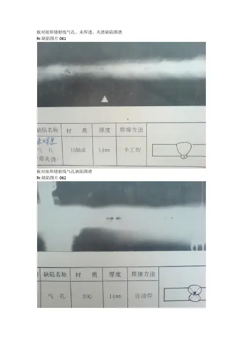 无损检测rt缺陷图谱续集 04