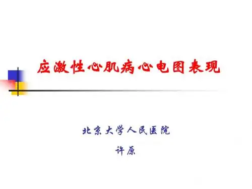 许原-应激性心肌病心电图表现(07年心电学论坛-北京)