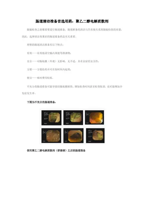肠道清洁准备首选用药