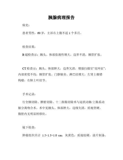 胰腺病理报告