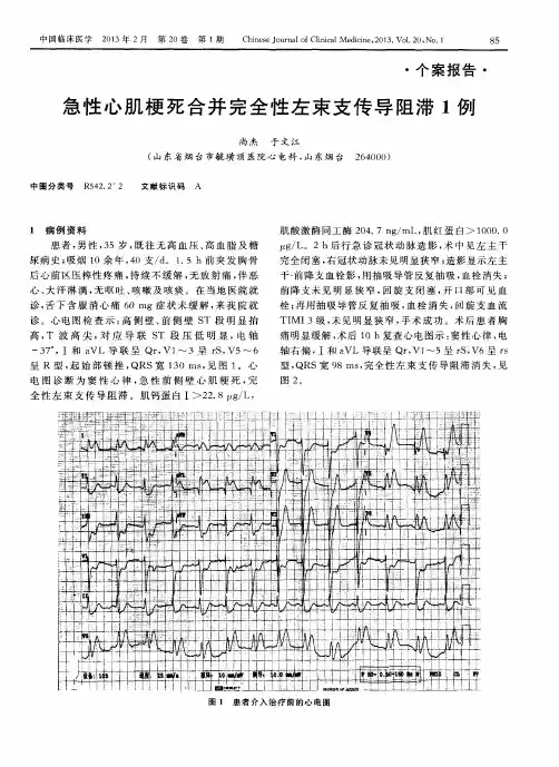 急性心肌梗死合并完全性左束支传导阻滞1例