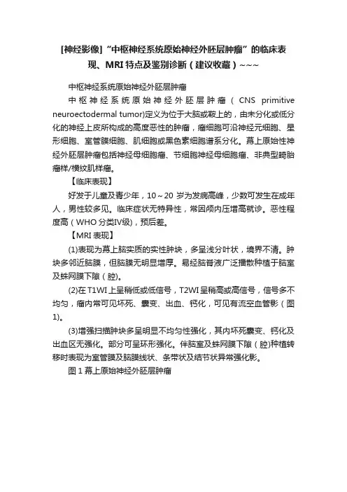 [神经影像]“中枢神经系统原始神经外胚层肿瘤”的临床表现、MRI特点及鉴别诊断（建议收藏）~~~