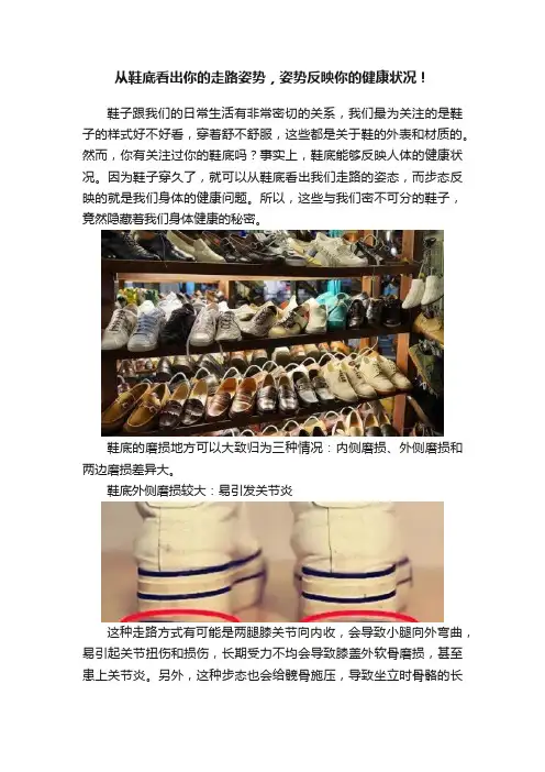 从鞋底看出你的走路姿势，姿势反映你的健康状况！