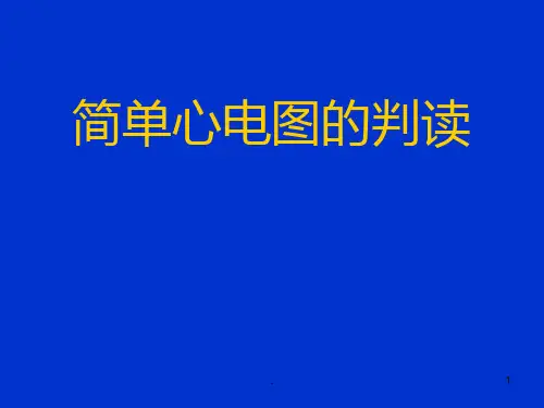 《心电图判读》PPT课件