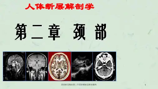 颈部断层解剖第二节颈部横断层解剖最终课件