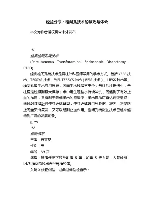 经验分享：椎间孔技术的技巧与体会